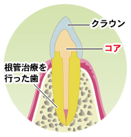 ファイバーコア