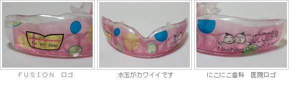 スポーツマウスガード